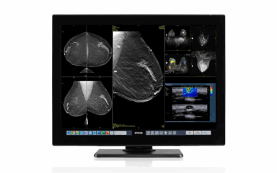 RAM-IT officieel distributiepartner Barco Coronis OneLook-programma.