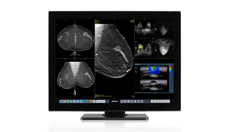 Coronis-OneLook-MDMC-nwsbrf Distributeur Barco Coronis OneLook programma